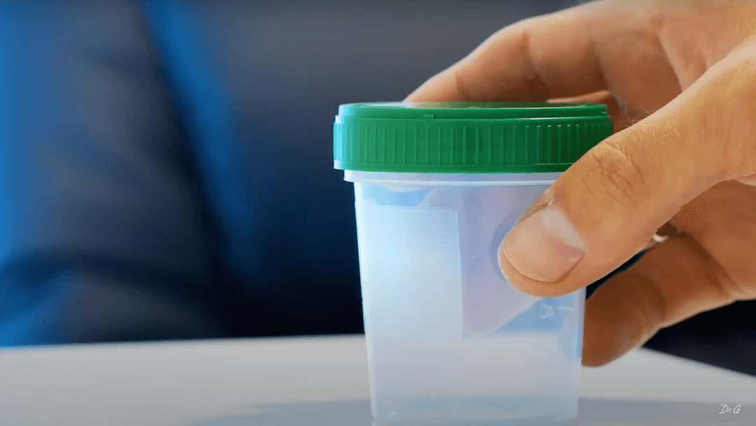 Espermatograma: ¿En qué laboratorio se puede realizar?