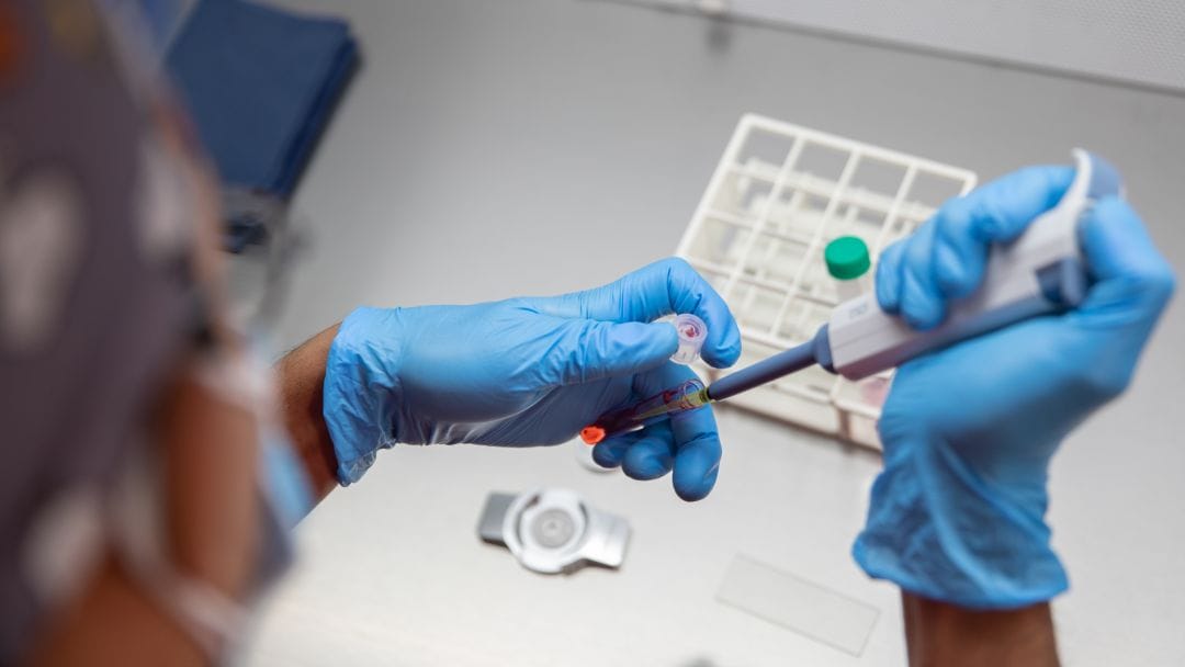 Fecundación In Vitro en EmbryoFertility