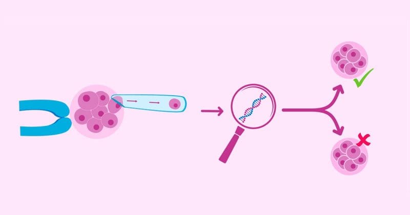 Ilustración de una biopsia embrionaria que muestra el análisis de una célula mediante una lupa para detectar alteraciones genéticas.