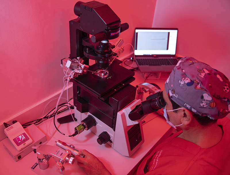 inyeccion-intracitoplasmica-de-espermatozoide